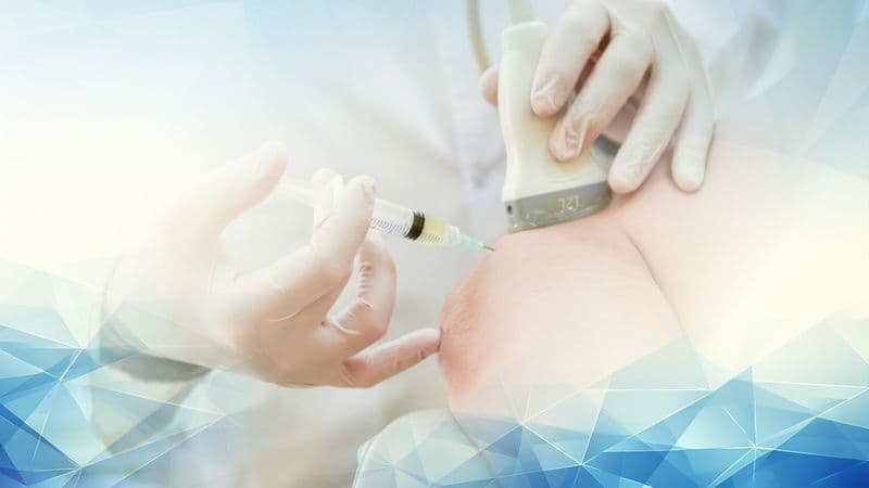 Arthrosamid Injections: Understanding Safety, Long-term Risks, and What Patients Can Expect