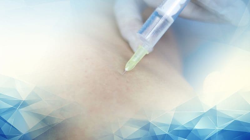 Arthrosamid Hydrogel Injections for Long Lasting Knee Osteoarthritis Pain Relief