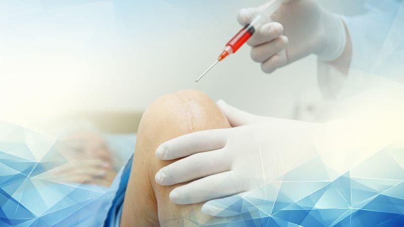 The Science Behind Hyaluronic Acid Injections: How Joint Lubrication Therapy Eases Osteoarthritis Pain Without Surgery